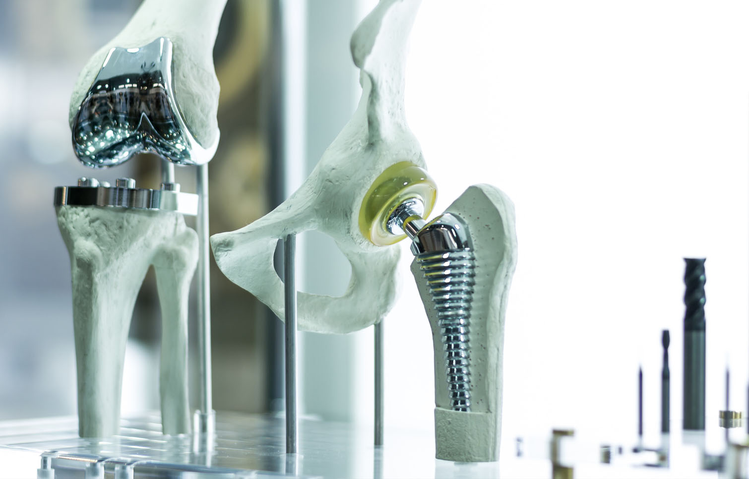 Damit Gelenkprothesen länger halten, entwickeln Forscher des IW eine verbesserte Keramikschutzschicht